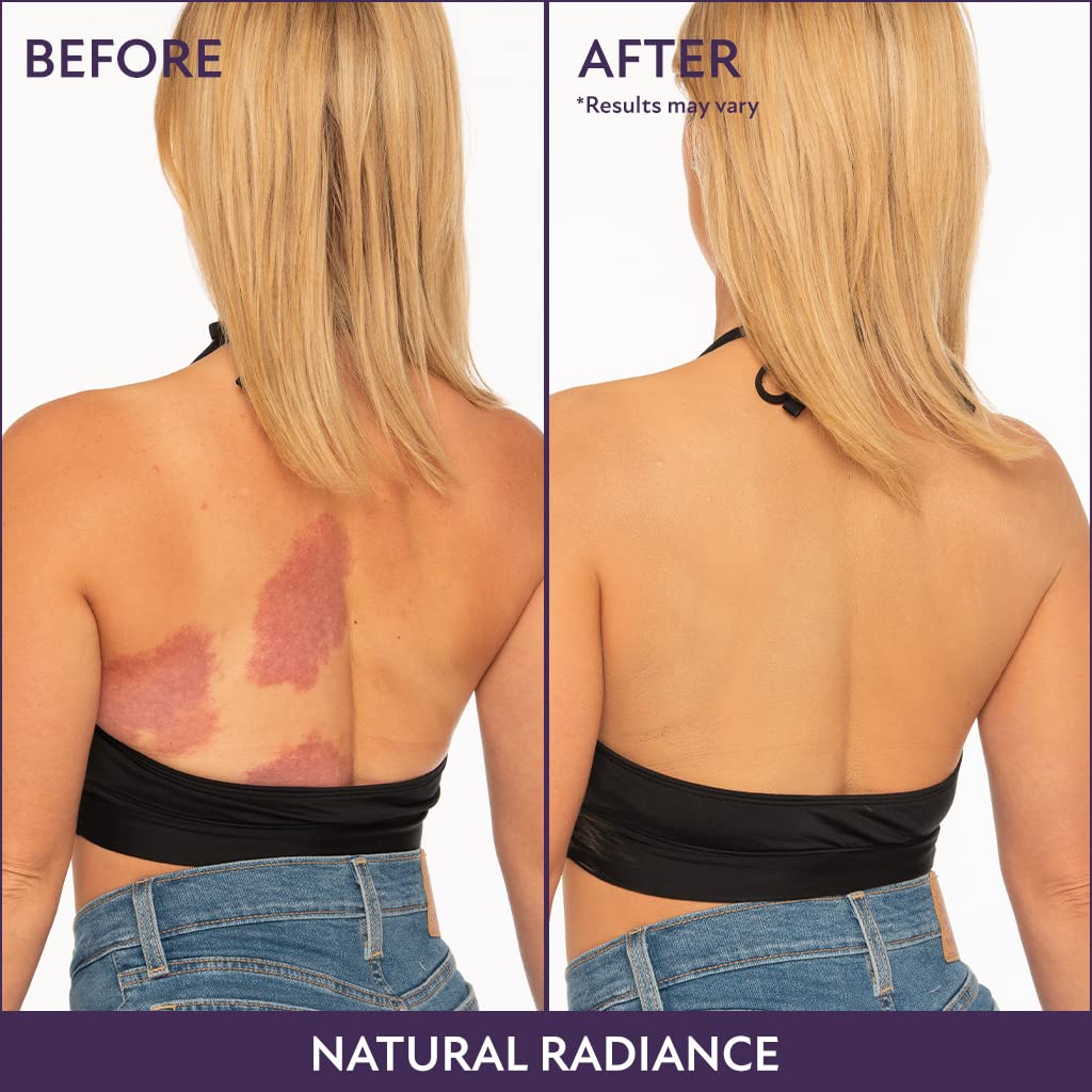 🔥Last Day-Buy 1 Get 1 Free!🎁All-in-one Moisturizer, Concealer & Coverage 💧✨ Lightweight & waterproof