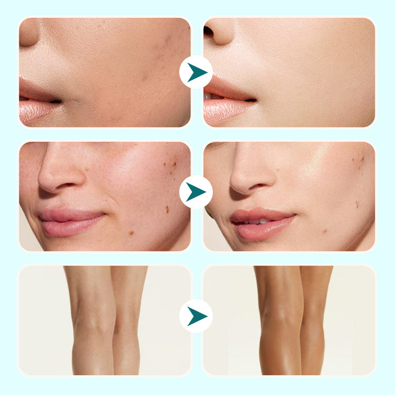 💜LAST DAY - BUY 1 GET 1 FREE💜All-in-One Moisturizing Concealer Waterproof Cream